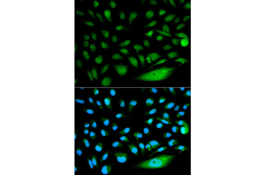 Immunofluorescence - SMAD1 Antibody from Signalway Antibody (32160) - Antibodies.com
