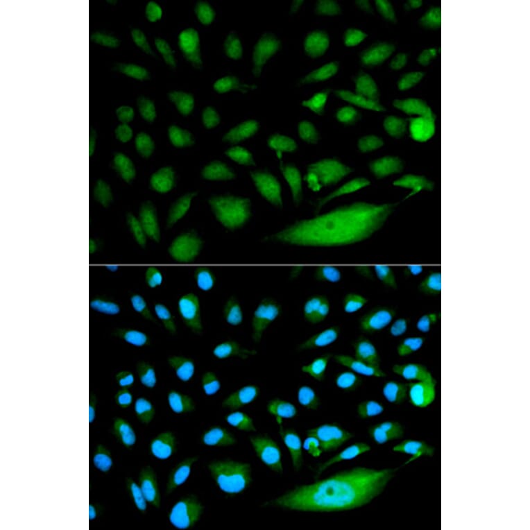 Immunofluorescence - SMAD1 Antibody from Signalway Antibody (32160) - Antibodies.com