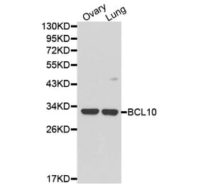 Western blot - BCL10 Antibody from Signalway Antibody (32162) - Antibodies.com