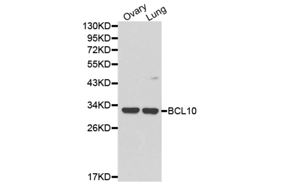 Western blot - BCL10 Antibody from Signalway Antibody (32162) - Antibodies.com