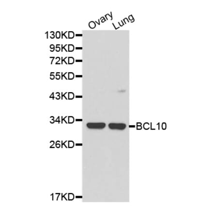 Western blot - BCL10 Antibody from Signalway Antibody (32162) - Antibodies.com