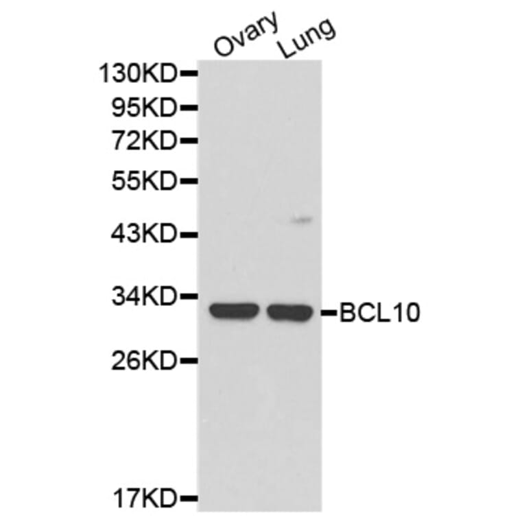 Western blot - BCL10 Antibody from Signalway Antibody (32162) - Antibodies.com