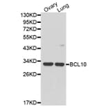 Western blot - BCL10 Antibody from Signalway Antibody (32162) - Antibodies.com