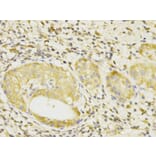 Immunohistochemistry - BCL10 Antibody from Signalway Antibody (32162) - Antibodies.com