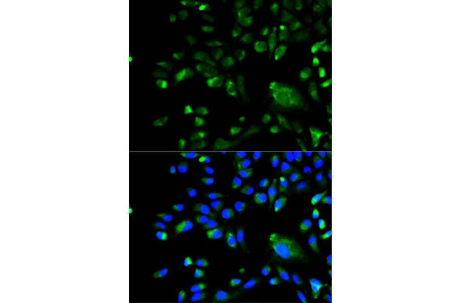 Immunofluorescence - BCL10 Antibody from Signalway Antibody (32162) - Antibodies.com