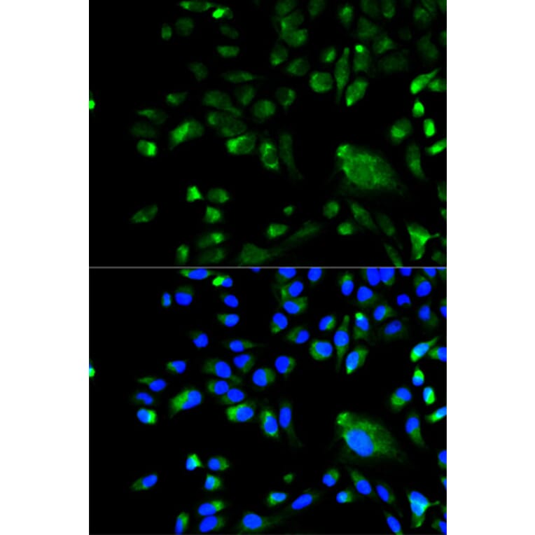 Immunofluorescence - BCL10 Antibody from Signalway Antibody (32162) - Antibodies.com