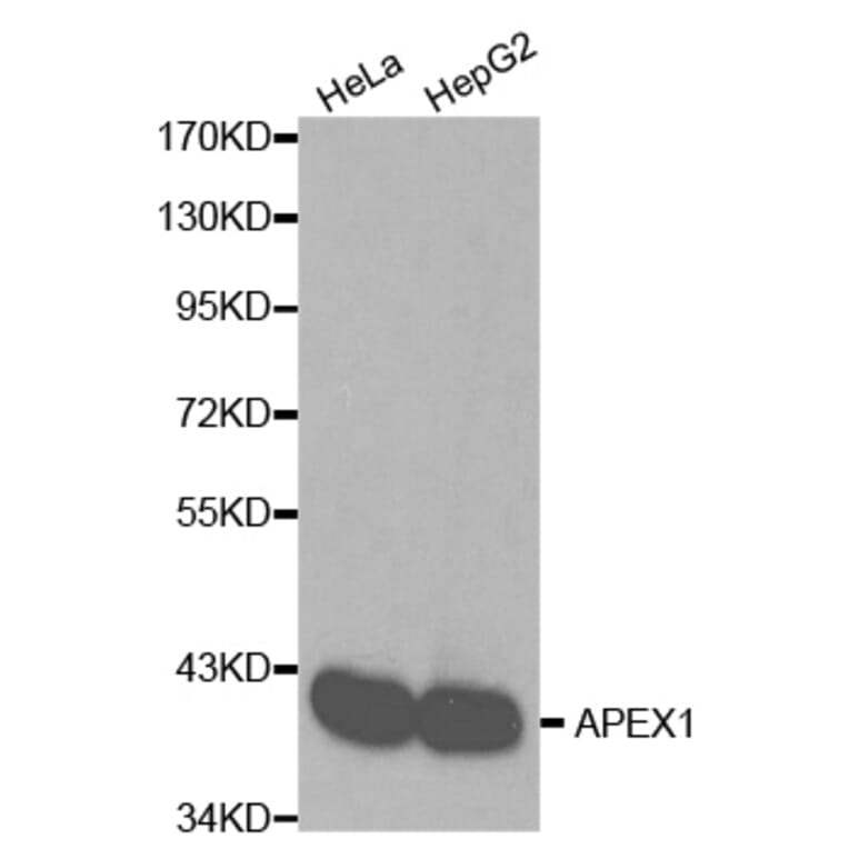 Western blot - APEX1 Antibody from Signalway Antibody (32167) - Antibodies.com