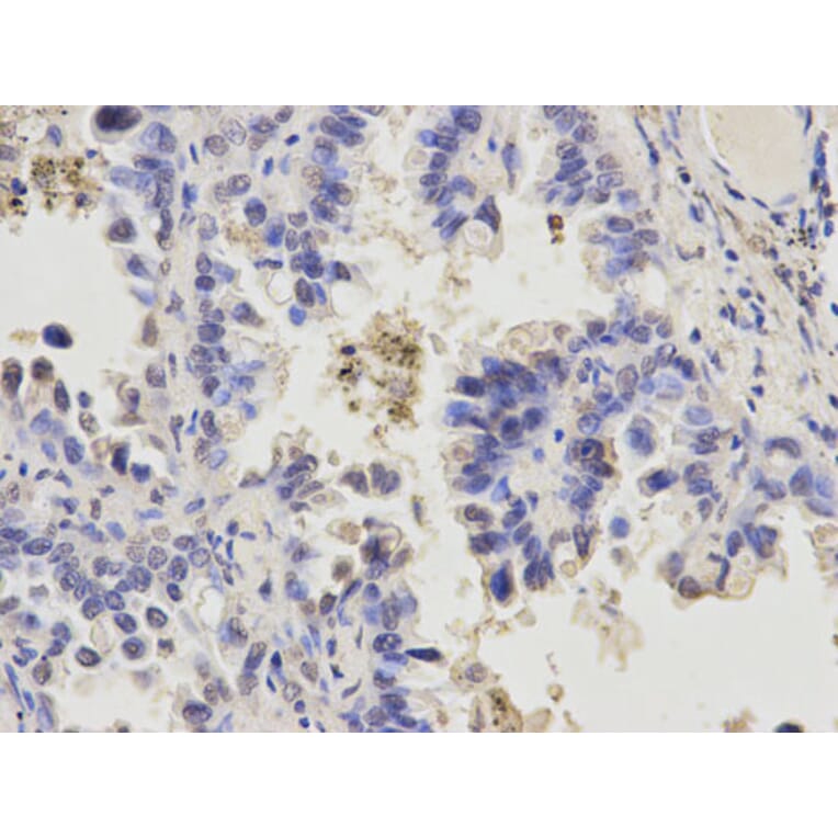 Immunohistochemistry - APEX1 Antibody from Signalway Antibody (32167) - Antibodies.com