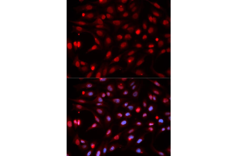 Immunofluorescence - APEX1 Antibody from Signalway Antibody (32167) - Antibodies.com