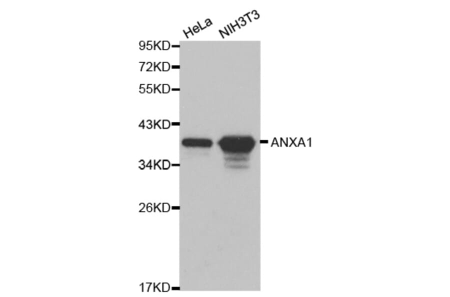 Western blot - ANXA1 Antibody from Signalway Antibody (32168) - Antibodies.com