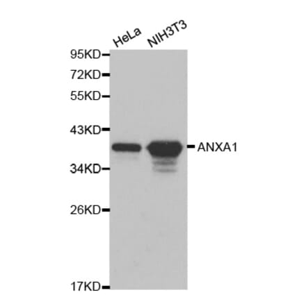 Western blot - ANXA1 Antibody from Signalway Antibody (32168) - Antibodies.com