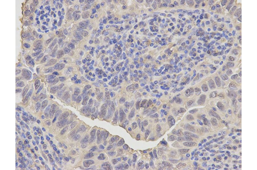 Immunohistochemistry - ANXA1 Antibody from Signalway Antibody (32168) - Antibodies.com