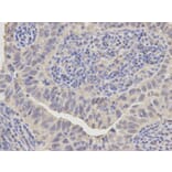 Immunohistochemistry - ANXA1 Antibody from Signalway Antibody (32168) - Antibodies.com