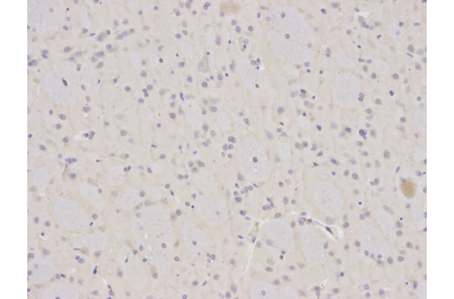 Immunohistochemistry - ANXA1 Antibody from Signalway Antibody (32168) - Antibodies.com