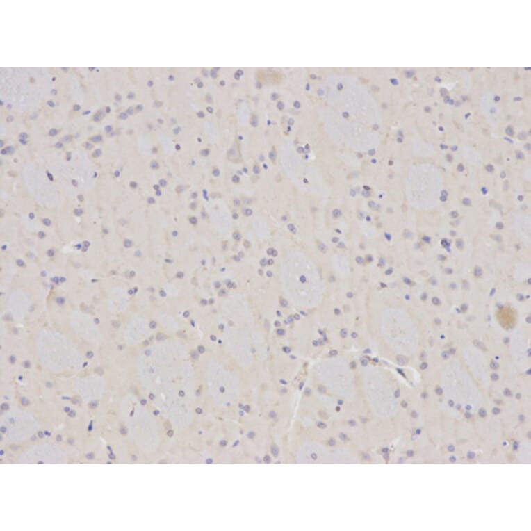 Immunohistochemistry - ANXA1 Antibody from Signalway Antibody (32168) - Antibodies.com