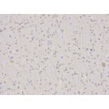 Immunohistochemistry - ANXA1 Antibody from Signalway Antibody (32168) - Antibodies.com
