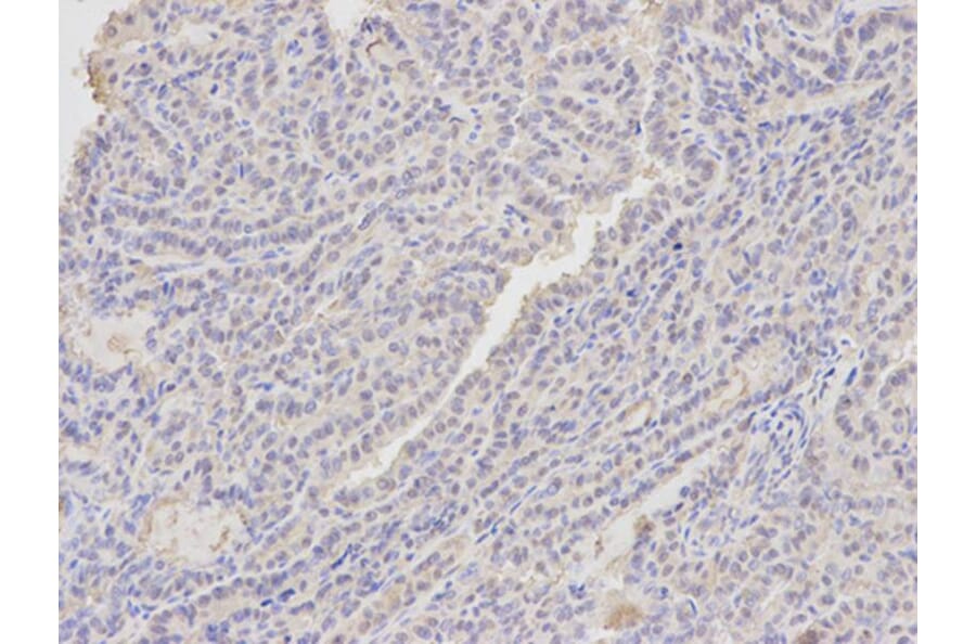 Immunohistochemistry - ANXA1 Antibody from Signalway Antibody (32168) - Antibodies.com