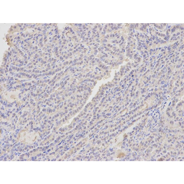 Immunohistochemistry - ANXA1 Antibody from Signalway Antibody (32168) - Antibodies.com
