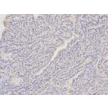 Immunohistochemistry - ANXA1 Antibody from Signalway Antibody (32168) - Antibodies.com