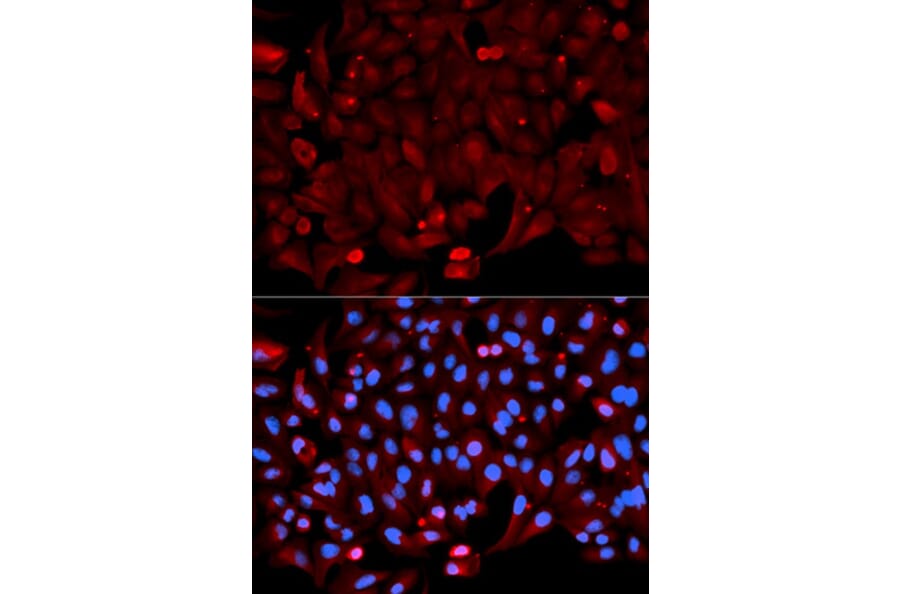 Immunofluorescence - ANXA1 Antibody from Signalway Antibody (32168) - Antibodies.com