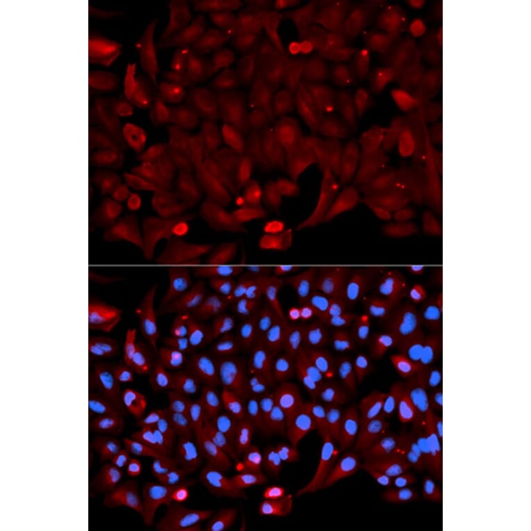 Immunofluorescence - ANXA1 Antibody from Signalway Antibody (32168) - Antibodies.com