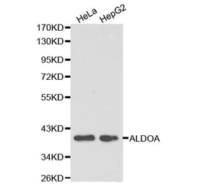 Western blot - ALDOA Antibody from Signalway Antibody (32178) - Antibodies.com