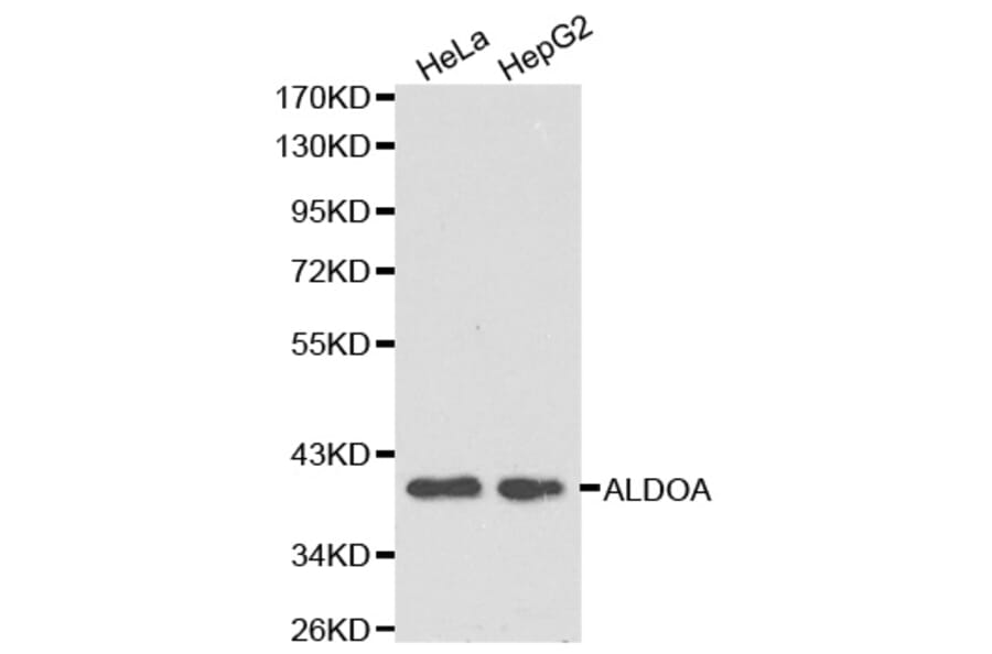 Western blot - ALDOA Antibody from Signalway Antibody (32178) - Antibodies.com