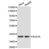 Western blot - ALDOA Antibody from Signalway Antibody (32178) - Antibodies.com