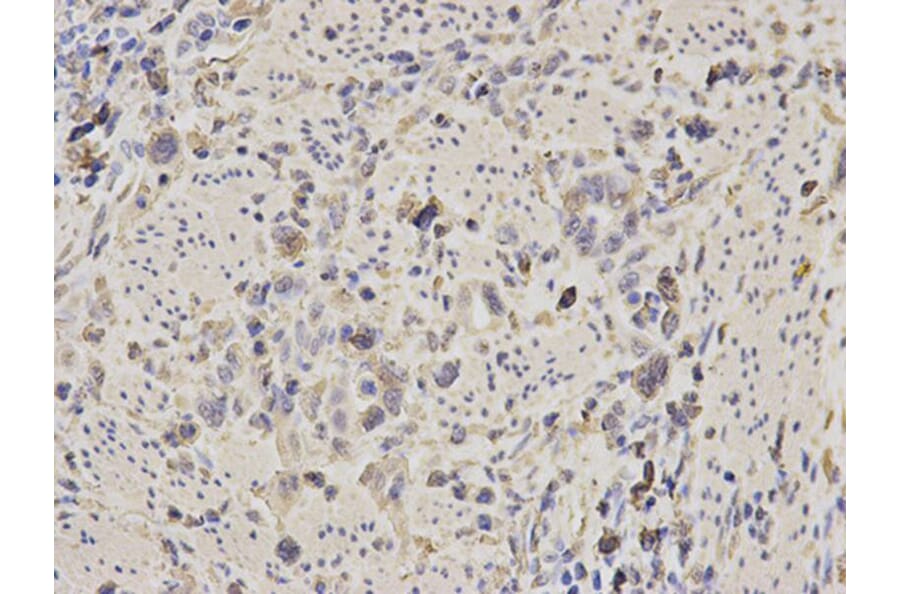 Immunohistochemistry - ALDOA Antibody from Signalway Antibody (32178) - Antibodies.com