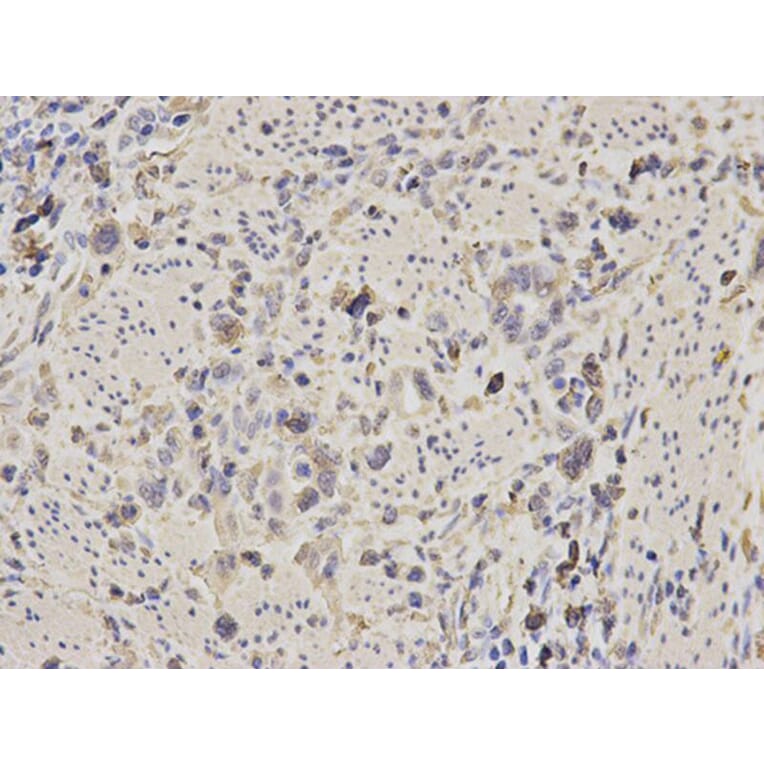 Immunohistochemistry - ALDOA Antibody from Signalway Antibody (32178) - Antibodies.com