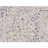 Immunohistochemistry - ALDOA Antibody from Signalway Antibody (32178) - Antibodies.com