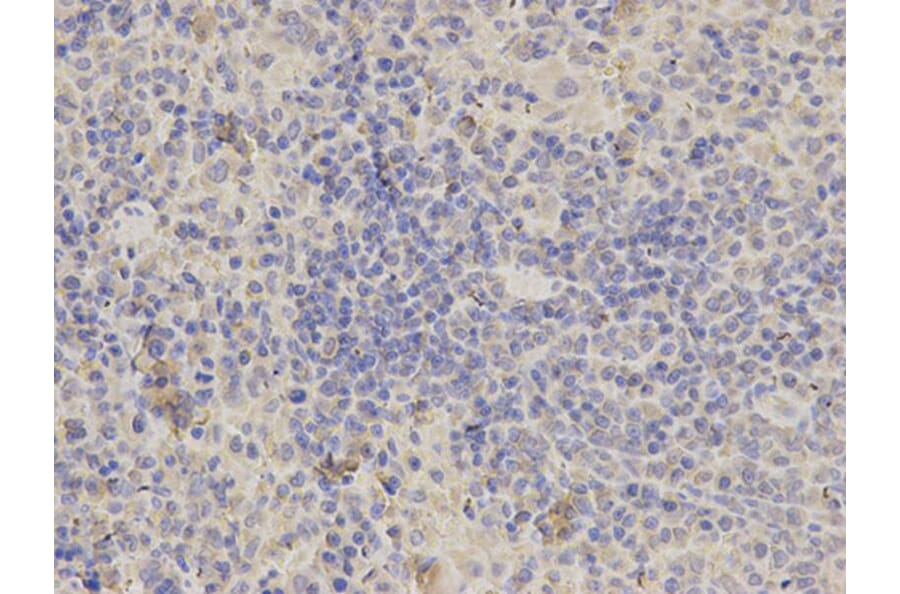 Immunohistochemistry - ALDOA Antibody from Signalway Antibody (32178) - Antibodies.com