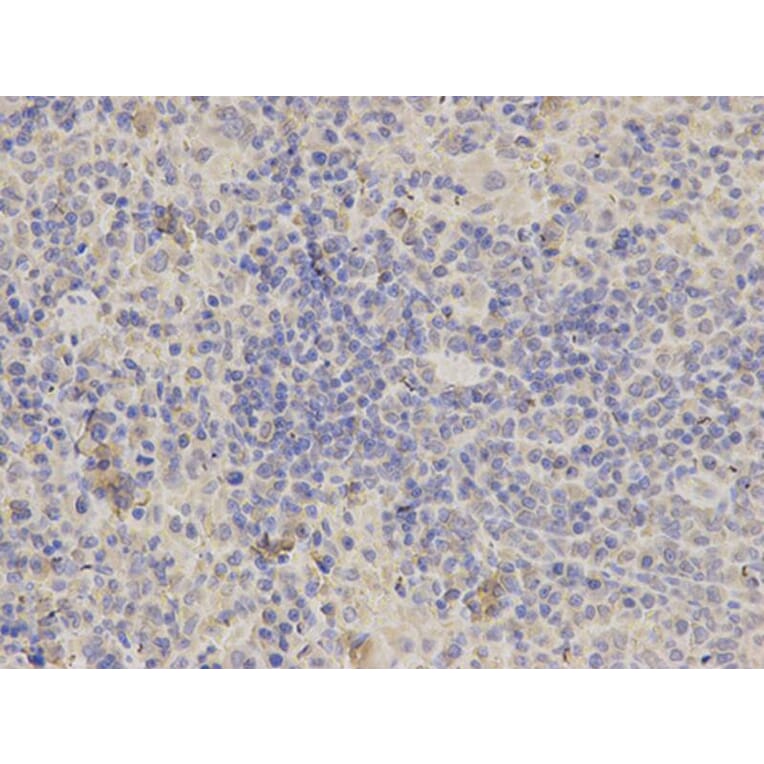 Immunohistochemistry - ALDOA Antibody from Signalway Antibody (32178) - Antibodies.com