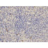 Immunohistochemistry - ALDOA Antibody from Signalway Antibody (32178) - Antibodies.com