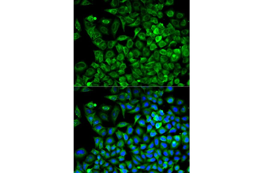 Immunofluorescence - ALDOA Antibody from Signalway Antibody (32178) - Antibodies.com