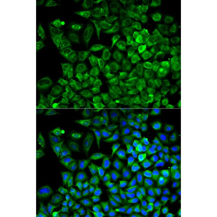 Immunofluorescence - ALDOA Antibody from Signalway Antibody (32178) - Antibodies.com