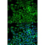 Immunofluorescence - ALDOA Antibody from Signalway Antibody (32178) - Antibodies.com