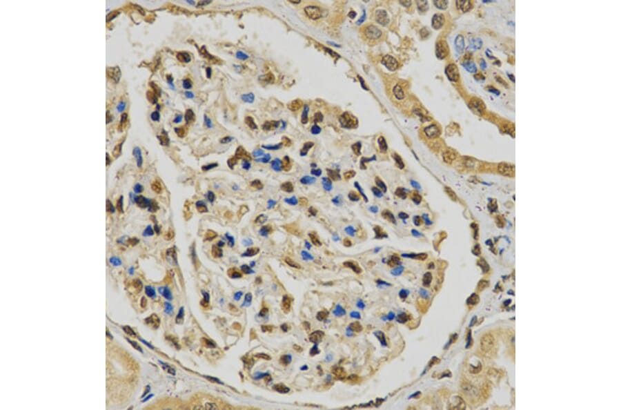 Immunohistochemistry - EGLN1 Antibody from Signalway Antibody (32185) - Antibodies.com