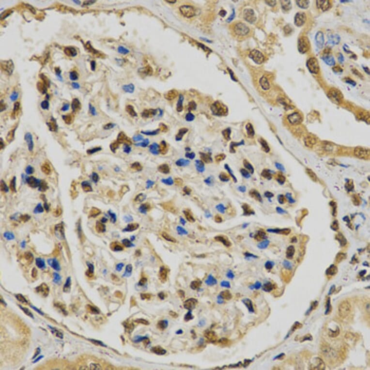 Immunohistochemistry - EGLN1 Antibody from Signalway Antibody (32185) - Antibodies.com