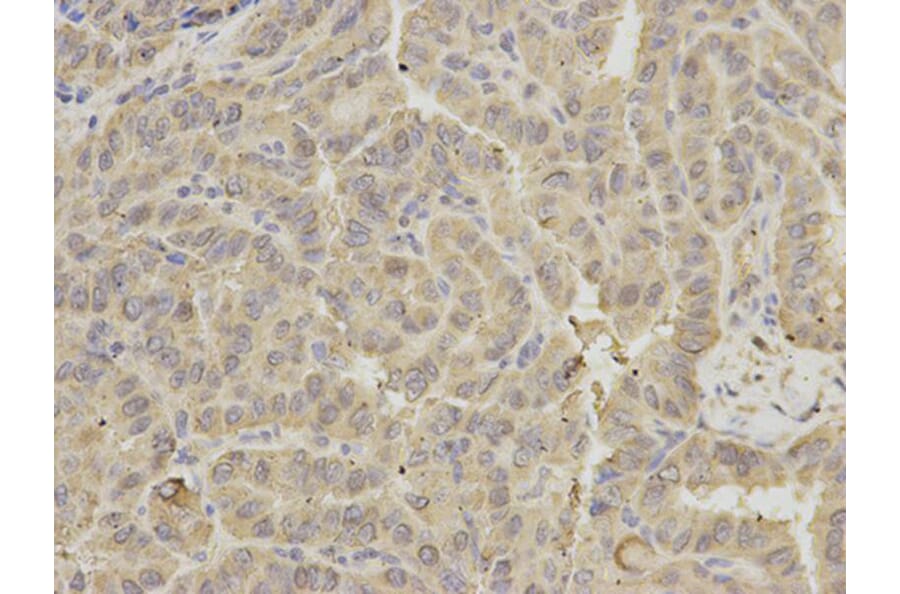 Immunohistochemistry - GRIA3 Antibody from Signalway Antibody (32191) - Antibodies.com