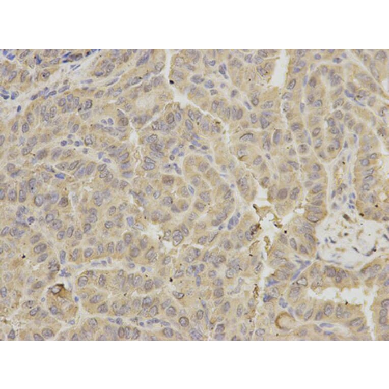 Immunohistochemistry - GRIA3 Antibody from Signalway Antibody (32191) - Antibodies.com