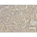 Immunohistochemistry - GRIA3 Antibody from Signalway Antibody (32191) - Antibodies.com
