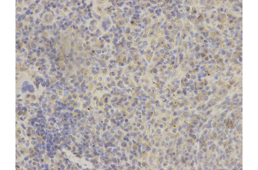 Immunohistochemistry - GRIA3 Antibody from Signalway Antibody (32191) - Antibodies.com