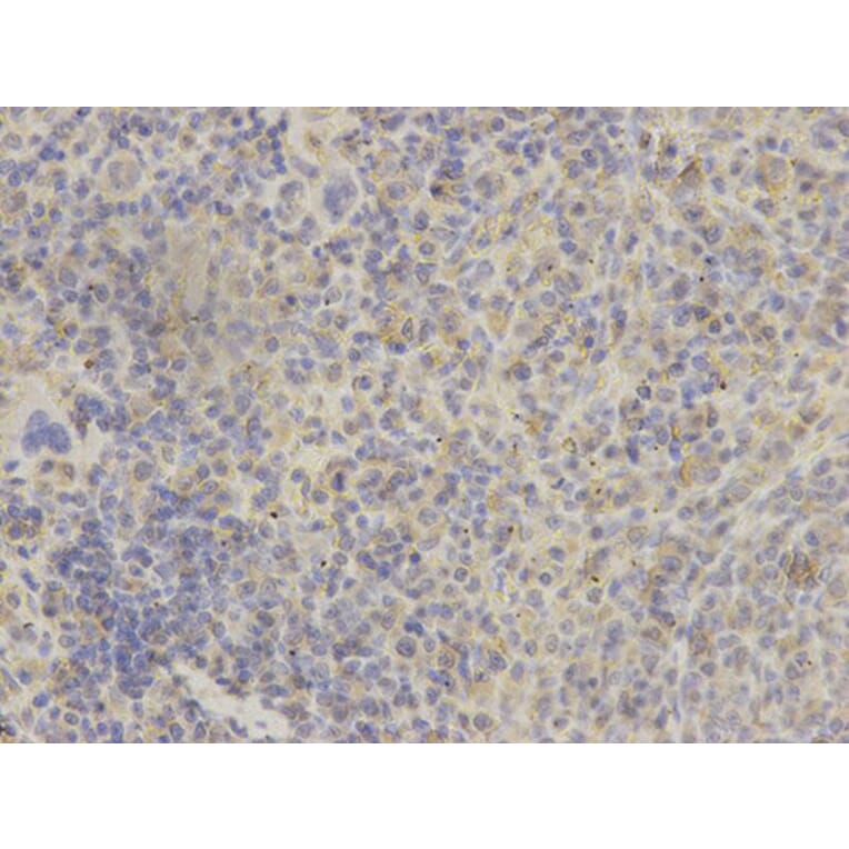 Immunohistochemistry - GRIA3 Antibody from Signalway Antibody (32191) - Antibodies.com