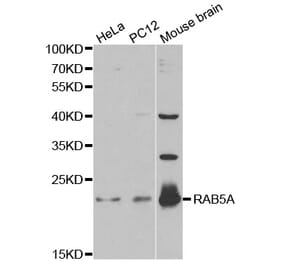 Western blot - RAB5A Antibody from Signalway Antibody (32209) - Antibodies.com