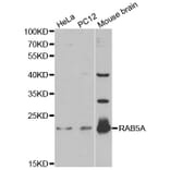 Western blot - RAB5A Antibody from Signalway Antibody (32209) - Antibodies.com