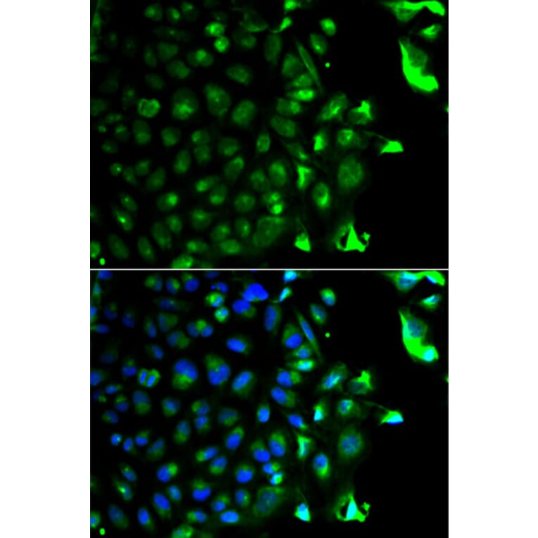 Immunofluorescence - RAB5A Antibody from Signalway Antibody (32209) - Antibodies.com