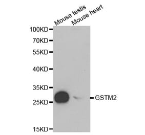Western blot - GSTM2 Antibody from Signalway Antibody (32228) - Antibodies.com