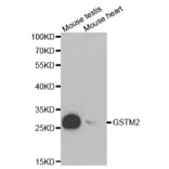 Western blot - GSTM2 Antibody from Signalway Antibody (32228) - Antibodies.com