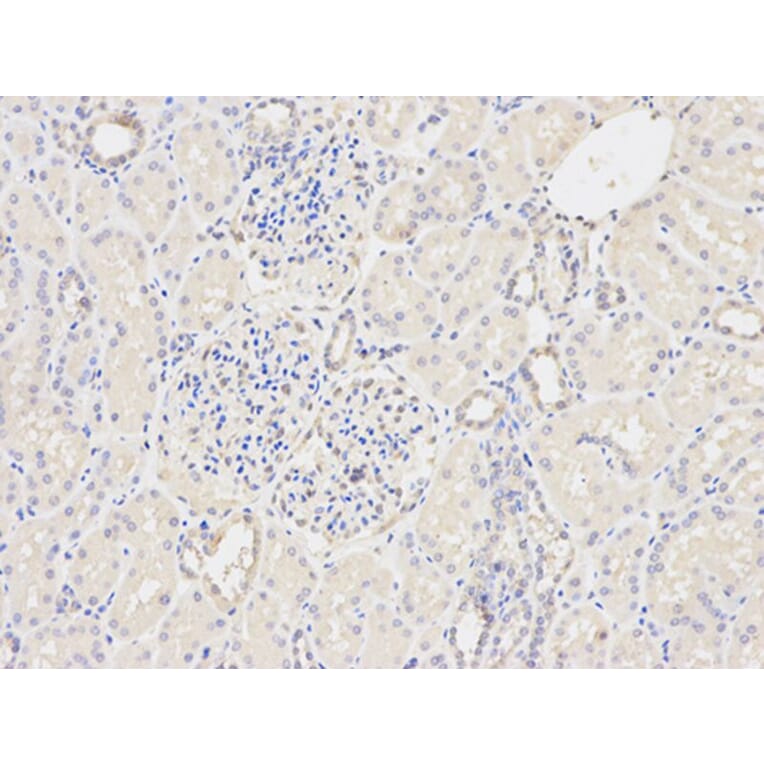 Immunohistochemistry - GSTM2 Antibody from Signalway Antibody (32228) - Antibodies.com